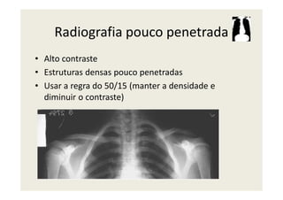 Radiografia pouco penetrada
• Alto contraste
• Estruturas densas pouco penetradas
• Usar a regra do 50/15 (manter a densidade e
diminuir o contraste)diminuir o contraste)
 