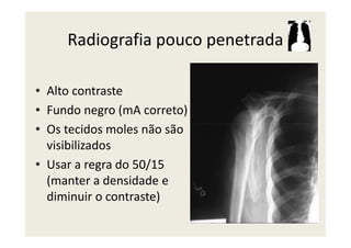 Radiografia pouco penetrada
• Alto contraste
• Fundo negro (mA correto)
• Os tecidos moles não são• Os tecidos moles não são
visibilizados
• Usar a regra do 50/15
(manter a densidade e
diminuir o contraste)
 