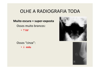 OLHE A RADIOGRAFIA TODA
Muito escura = super-exposta
Ossos muito brancos:
• kV
Ossos “cinza”:
• mAs
 