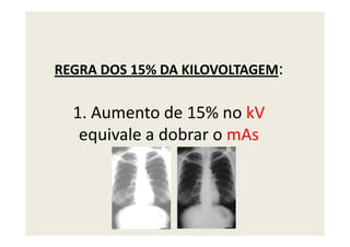 REGRA DOS 15% DA KILOVOLTAGEM:
1. Aumento de 15% no kV
equivale a dobrar o mAsequivale a dobrar o mAs
 
