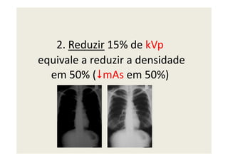 2. Reduzir 15% de kVp
equivale a reduzir a densidade
em 50% ( mAs em 50%)em 50% ( mAs em 50%)
 