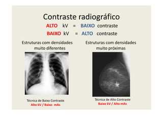 Contraste radiográfico
Estruturas com densidades
muito diferentes
Estruturas com densidades
muito próximas
ALTO kV = BAIXO contraste
BAIXO kV = ALTO contraste
Técnica de Alto Contraste
Baixo kV / Alto mAs
Técnica de Baixo Contraste
Alto kV / Baixo mAs
 