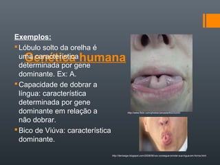 Exemplos:
 Lóbulo solto da orelha é
   Genética humana
  uma característica
  determinada por gene
  dominante. Ex: A.
 Capacidade de dobrar a
  língua: característica
  determinada por gene
  dominante em relação a                       http://www.flickr.com/photos/cansada/60233200/


  não dobrar.
 Bico de Viúva: característica
  dominante.

                                  http://denisegw.blogspot.com/2008/08/voc-consegue-enrolar-sua-lngua-em-forma.html
 