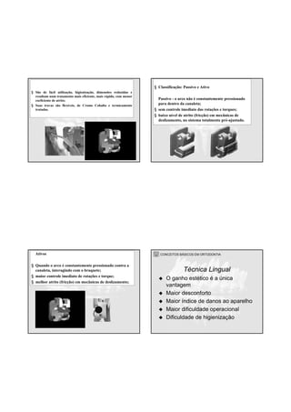 CONCEITOS BÁSICOS EM ORTODONTIA
§ São de fácil utilização, higienização, dimensões reduzidas e
resultam num tratamento mais eficiente, mais rápido, com menor
coeficiente de atrito;
§ Suas travas são flexíveis, de Cromo Cobalto e termicamente
tratadas.
CONCEITOS BÁSICOS EM ORTODONTIA
§ Classificação: Passivo e Ativo
Passivo - o arco não é constantemente pressionado
para dentro da canaleta;
§ sem controle imediato das rotações e torques;
§ baixo nível de atrito (fricção) em mecânicas de
deslizamento, no sistema totalmente pré-ajustado.
CONCEITOS BÁSICOS EM ORTODONTIAAtivos
§ Quando o arco é constantemente pressionado contra a
canaleta, interagindo com o braquete;
§ maior controle imediato de rotações e torque;
§ melhor atrito (fricção) em mecânicas de deslizamento;
CONCEITOS BÁSICOS EM ORTODONTIA
O ganho estético é a única
vantagem
Maior desconforto
Maior índice de danos ao aparelho
Maior dificuldade operacional
Dificuldade de higienização
Técnica Lingual
 