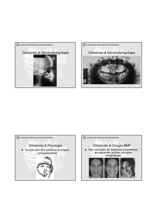 CONCEITOS BÁSICOS EM ORTODONTIA
Ortodontia & Otorrinolaringologia
CONCEITOS BÁSICOS EM ORTODONTIA
Ortodontia & Otorrinolaringologia
CONCEITOS BÁSICOS EM ORTODONTIA
Sucção sem fins nutritivos de origem
comportamental
Ortodontia & Psicologia
CONCEITOS BÁSICOS EM ORTODONTIA
Nas correções de displasias esqueléticas
em pacientes adultos (cirurgias
ortognáticas)
Ortodontia & Cirurgia BMF
 