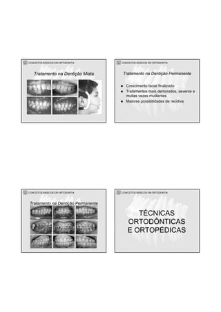 CONCEITOS BÁSICOS EM ORTODONTIA
Tratamento na Dentição Mista
CONCEITOS BÁSICOS EM ORTODONTIA
Crescimento facial finalizado
Tratamentos mais demorados, severos e
muitas vezes mutilantes
Maiores possibilidades de recidiva
Tratamento na Dentição Permanente
CONCEITOS BÁSICOS EM ORTODONTIA
Tratamento na Dentição Permanente
CONCEITOS BÁSICOS EM ORTODONTIA
TÉCNICAS
ORTODÔNTICAS
E ORTOPÉDICAS
 