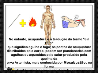 No entanto, acupuntura é a tradução do termo “Jin
                         Huo”
que significa agulha e fogo; os pontos de acupuntura
distribuídos pelo corpo, podem ser puncionados com
   agulhas ou aquecidos pelo calor produzido pela
                      queima da
erva Artemísia, mais conhecida por Moxabustão, na
                        forma
de um bastão que é aproximado da pele para aquecer
 