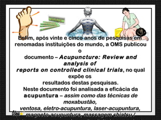 Enfim, após vinte e cinco anos de pesquisas em
renomadas instituições do mundo, a OMS publicou
                          o
    documento – Acupuncture: Review and
                    analysis of
 reports on controlled clinical trials , no qual
                      expõe os
           resultados destas pesquisas.
   Neste documento foi analisada a eficácia da
    acupuntura – assim como das técnicas de
                   moxabustão,
  ventosa, eletro-acupuntura, laser-acupuntura,
    magneto-acupuntura, massagem shiatsu /
 