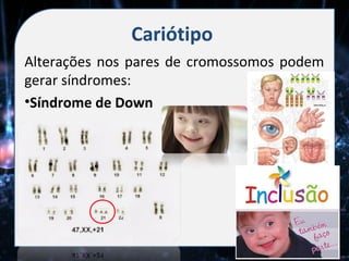 Cariótipo
Alterações nos pares de cromossomos podem
gerar síndromes:
•Síndrome de Down
 