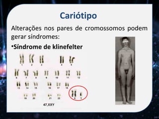 Cariótipo
Alterações nos pares de cromossomos podem
gerar síndromes:
•Síndrome de klinefelter
 