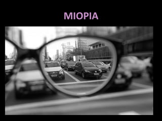 MIOPIA 
 
