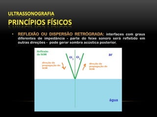 interfaces com graus
diferentes de impedância - parte do feixe sonoro será refletido em
outras direções - pode gerar sombra acústica posterior.
 