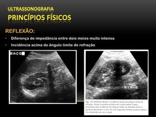 •  Diferença de impedância entre dois meios muito intensa
•  Incidência acima do ângulo limite de refração
 