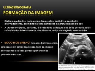 •  Sistemas pulsados: ondas em pulsos curtos, emitidos e recebidos
alternadamente, permitindo a caracterização da profundidade do eco.
•  A ultrassonografia, portanto, é o resultado da leitura dos ecos gerados pelas
reflexões dos feixes sonoros nos diversos meios ao longo do seu caminho.
(imagens bidimensionais,
estáticas e em tempo real): cada linha da imagem
corresponde aos ecos gerados por um único
pulso de ultrassom.
 