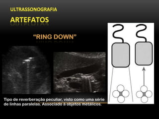 Tipo de reverberação peculiar, visto como uma série
de linhas paralelas. Associado à objetos metálicos.
 