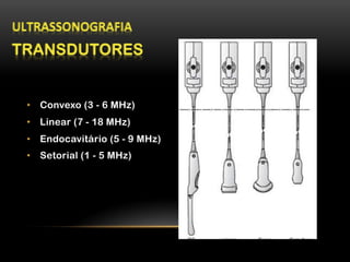 •  Convexo (3 - 6 MHz)
•  Linear (7 - 18 MHz)
•  Endocavitário (5 - 9 MHz)
•  Setorial (1 - 5 MHz)
 