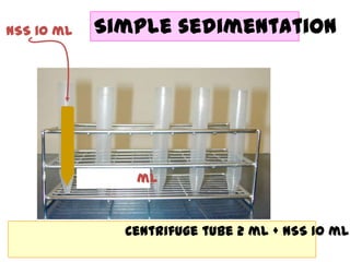 NSS 10 ml

Simple sedimentation

ml

Centrifuge tube 2 ml + NSS 10 ml

 