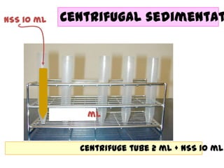 NSS 10 ml

Centrifugal sedimentat

ml

Centrifuge tube 2 ml + NSS 10 ml

 