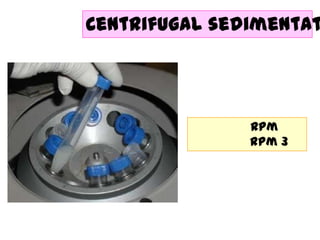 Centrifugal sedimentat

rpm
rpm 3

 
