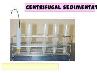 Centrifugal sedimentat

 
