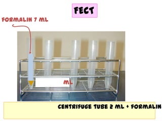 FECT
formalin 7 ml

ml

Centrifuge tube 2 ml + formalin

 