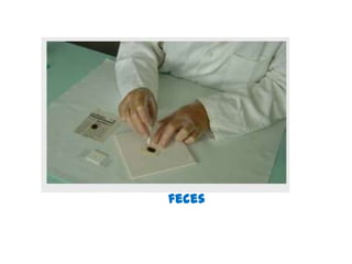 feces

 