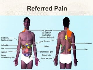 Referred Pain 