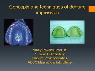 Concepts and techniques of denture
impression
Vinay PavanKumar .K
1st year PG Student
Dept of Prosthodontics
AECS Maaruti dental college
 
