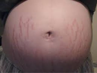 conception and adaptation to preg.pptx,,