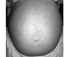 conception and adaptation to preg.pptx,,
