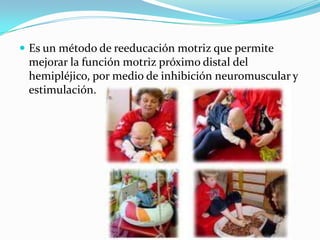  Es un método de reeducación motriz que permite
 mejorar la función motriz próximo distal del
 hemipléjico, por medio de inhibición neuromuscular y
 estimulación.
 