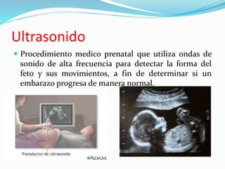  Procedimiento medico prenatal que utiliza ondas de
sonido de alta frecuencia para detectar la forma del
feto y sus movimientos, a fin de determinar si un
embarazo progresa de manera normal.
Ultrasonido
 