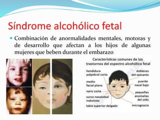  Combinación de anormalidades mentales, motoras y
de desarrollo que afectan a los hijos de algunas
mujeres que beben durante el embarazo
Síndrome alcohólico fetal
 