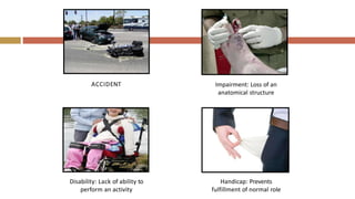 ACCIDENT Impairment: Loss of an
anatomical structure
Disability: Lack of ability to
perform an activity
Handicap: Prevents
fulfillment of normal role
 