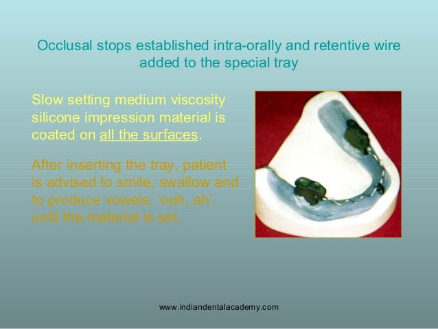 Concept of neutral zone/ dental seminars