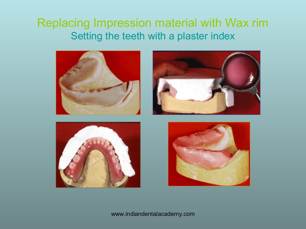 Concept of neutral zone/ dental seminars