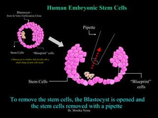 “Blueprint”
cells
Human Embryonic Stem Cells
Pipette
Stem Cells
To remove the stem cells, the Blastocyst is opened and
the stem cells removed with a pipette
Blastocyst -
from In Vitro Fertilization Clinic
Stem Cells “Blueprint” cells
A Blastocyst is a hollow ball of cells with a
small clump of stem cells inside
Dr. Monika Nema
 