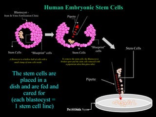 Pipette
Pipette
Stem Cells
Petri Dish
Human Embryonic Stem Cells
To remove the stem cells, the Blastocyst is
broken open and the stem cells removed with
a pipette(an ultra thin glass tube)
The stem cells are
placed in a
dish and are fed and
cared for
(each blastocyst =
1 stem cell line)
Blastocyst -
from In Vitro Fertilization Clinic
Stem Cells “Blueprint” cells
A Blastocyst is a hollow ball of cells with a
small clump of stem cells inside
Stem Cells
“Blueprint”
cells
Dr. Monika Nema
 