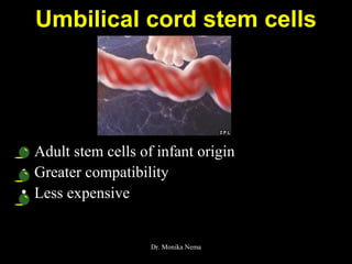 Umbilical cord stem cells
• Adult stem cells of infant origin
• Greater compatibility
• Less expensive
Dr. Monika Nema
 