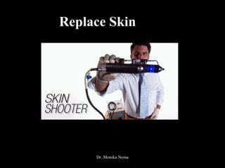 Replace Skin
Dr. Monika Nema
 