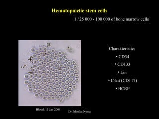 Hematopoietic stem cells
1 / 25 000 - 100 000 of bone marrow cells
Charakteristic:
• CD34
• CD133
• Lin-
• C-kit (CD117)
• BCRP
Blood, 15 Jan 2004
Dr. Monika Nema
 