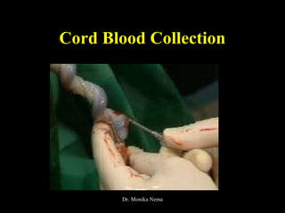 Cord Blood Collection
Dr. Monika Nema
 