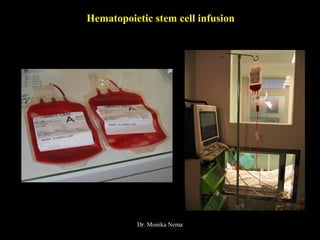 Hematopoietic stem cell infusion
Dr. Monika Nema
 