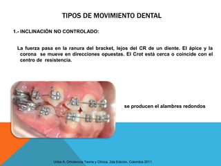 Conceptos basicos de biomecanica en ortodoncia | PPTX