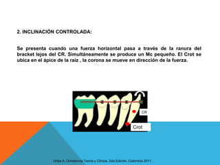 2. INCLINACIÓN CONTROLADA:


Se presenta cuando una fuerza horizontal pasa a través de la ranura del
bracket lejos del CR. Simultáneamente se produce un Mc pequeño. El Crot se
ubica en el ápice de la raíz , la corona se mueve en dirección de la fuerza.




                                                                        CR



                                                                  Crot




              Uribe A, Ortodoncia Teoría y Clínica, 2da Edición, Colombia 2011.
 