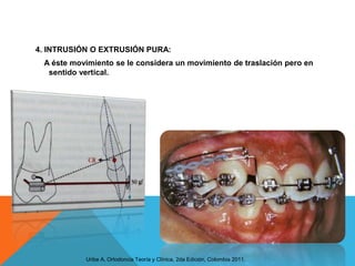 4. INTRUSIÓN O EXTRUSIÓN PURA:
 A éste movimiento se le considera un movimiento de traslación pero en
  sentido vertical.




           Uribe A, Ortodoncia Teoría y Clínica, 2da Edición, Colombia 2011.
 