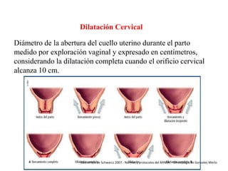 Dilatación Cervical
Diámetro de la abertura del cuello uterino durante el parto
medido por exploración vaginal y expresado en centímetros,
considerando la dilatación completa cuando el orificio cervical
alcanza 10 cm.

Obstetricia de Schwarcz 2007 - Normas y protocolos del MINSA. - Ginecología de Gonzales Merlo

 