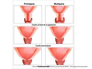 Obstetricia de Schwarcz 2007 - Normas y protocolos del MINSA. - Ginecología de Gonzales Merlo

 