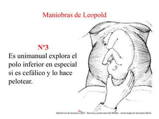 Maniobras de Leopold

Nº3
Es unimanual explora el
polo inferior en especial
si es cefálico y lo hace
pelotear.

Obstetricia de Schwarcz 2007 - Normas y protocolos del MINSA. - Ginecología de Gonzales Merlo

 