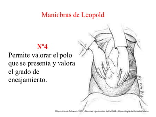 Maniobras de Leopold

Nº4
Permite valorar el polo
que se presenta y valora
el grado de
encajamiento.

Obstetricia de Schwarcz 2007 - Normas y protocolos del MINSA. - Ginecología de Gonzales Merlo

 